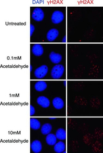 Mouse IgG (H+L) Highly Cross-Adsorbed Secondary Antibody in Immunocytochemistry (ICC/IF)