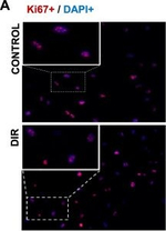Rabbit IgG (H+L) Cross-Adsorbed Secondary Antibody in Immunocytochemistry (ICC/IF)
