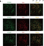 Rabbit IgG (H+L) Highly Cross-Adsorbed Secondary Antibody in Immunocytochemistry (ICC/IF)