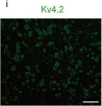 Rabbit IgG (H+L) Highly Cross-Adsorbed Secondary Antibody in Immunocytochemistry (ICC/IF)
