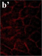 Mouse IgG (H+L) Cross-Adsorbed Secondary Antibody in Immunocytochemistry (ICC/IF)