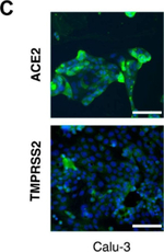 Rabbit IgG (H+L) Cross-Adsorbed Secondary Antibody in Immunocytochemistry (ICC/IF)