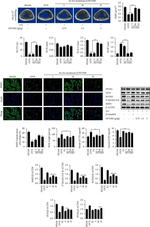 Rabbit IgG (H+L) Cross-Adsorbed Secondary Antibody in Western Blot (WB)