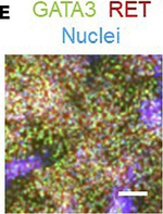 Rabbit IgG (H+L) Highly Cross-Adsorbed Secondary Antibody in Immunocytochemistry (ICC/IF)