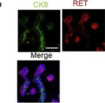Mouse IgG (H+L) Highly Cross-Adsorbed Secondary Antibody in Immunocytochemistry (ICC/IF)