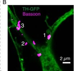 Mouse IgG (H+L) Highly Cross-Adsorbed Secondary Antibody in Immunocytochemistry (ICC/IF)