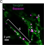 Mouse IgG (H+L) Highly Cross-Adsorbed Secondary Antibody in Immunocytochemistry (ICC/IF)