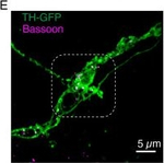 Mouse IgG (H+L) Highly Cross-Adsorbed Secondary Antibody in Immunocytochemistry (ICC/IF)