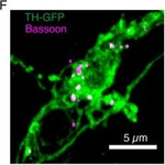 Mouse IgG (H+L) Highly Cross-Adsorbed Secondary Antibody in Immunocytochemistry (ICC/IF)