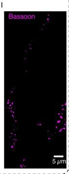 Mouse IgG (H+L) Highly Cross-Adsorbed Secondary Antibody in Immunocytochemistry (ICC/IF)