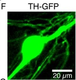 Rabbit IgG (H+L) Highly Cross-Adsorbed Secondary Antibody in Immunocytochemistry (ICC/IF)