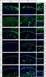 Rabbit IgG (H+L) Cross-Adsorbed Secondary Antibody in Immunocytochemistry (ICC/IF)