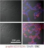 Rabbit IgG (H+L) Cross-Adsorbed Secondary Antibody in Immunocytochemistry (ICC/IF)