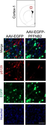 Rabbit IgG (H+L) Highly Cross-Adsorbed Secondary Antibody in Immunocytochemistry (ICC/IF)