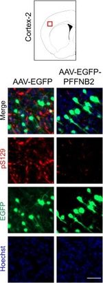 Rabbit IgG (H+L) Highly Cross-Adsorbed Secondary Antibody in Immunocytochemistry (ICC/IF)