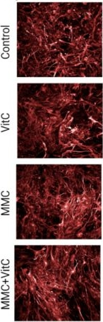 Rabbit IgG (Heavy chain) Secondary Antibody in Immunocytochemistry (ICC/IF)