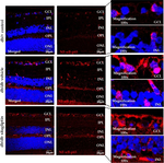 Mouse IgG (H+L) Highly Cross-Adsorbed Secondary Antibody in Immunohistochemistry (Paraffin) (IHC (P))