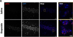 Rabbit IgG (H+L) Cross-Adsorbed Secondary Antibody in Immunocytochemistry (ICC/IF)