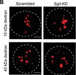 Rabbit IgG (H+L) Highly Cross-Adsorbed Secondary Antibody in Immunocytochemistry (ICC/IF)