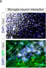 Guinea Pig IgG (H+L) Highly Cross-Adsorbed Secondary Antibody in Immunocytochemistry (ICC/IF)