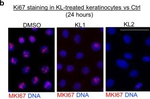 Mouse IgG (H+L) Cross-Adsorbed Secondary Antibody in Immunocytochemistry (ICC/IF)