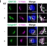 Mouse IgG (H+L) Highly Cross-Adsorbed Secondary Antibody in Immunocytochemistry (ICC/IF)