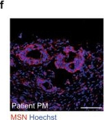 Rabbit IgG (H+L) Highly Cross-Adsorbed Secondary Antibody in Immunocytochemistry (ICC/IF)