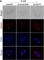 Rabbit IgG (H+L) Highly Cross-Adsorbed Secondary Antibody in Immunocytochemistry (ICC/IF)