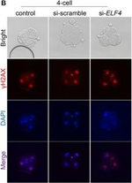 Rabbit IgG (H+L) Highly Cross-Adsorbed Secondary Antibody in Immunocytochemistry (ICC/IF)
