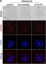 Rabbit IgG (H+L) Highly Cross-Adsorbed Secondary Antibody in Immunocytochemistry (ICC/IF)