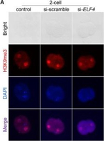 Rabbit IgG (H+L) Highly Cross-Adsorbed Secondary Antibody in Immunocytochemistry (ICC/IF)