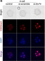 Rabbit IgG (H+L) Highly Cross-Adsorbed Secondary Antibody in Immunocytochemistry (ICC/IF)