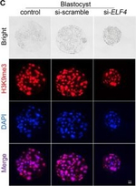 Rabbit IgG (H+L) Highly Cross-Adsorbed Secondary Antibody in Immunocytochemistry (ICC/IF)