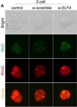Rabbit IgG (H+L) Highly Cross-Adsorbed Secondary Antibody in Immunocytochemistry (ICC/IF)