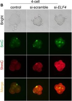 Rabbit IgG (H+L) Highly Cross-Adsorbed Secondary Antibody in Immunocytochemistry (ICC/IF)
