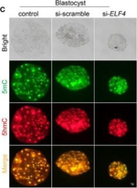 Rabbit IgG (H+L) Highly Cross-Adsorbed Secondary Antibody in Immunocytochemistry (ICC/IF)