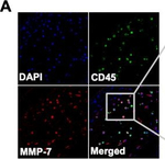 Rabbit IgG (H+L) Highly Cross-Adsorbed Secondary Antibody in Immunocytochemistry (ICC/IF)