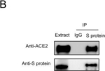 Goat IgG (H+L) Secondary Antibody in Western Blot (WB)