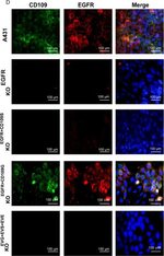 Mouse IgG (H+L) Highly Cross-Adsorbed Secondary Antibody in Immunocytochemistry (ICC/IF)