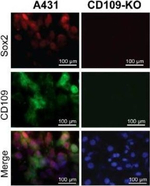 Mouse IgG (H+L) Highly Cross-Adsorbed Secondary Antibody in Immunocytochemistry (ICC/IF)