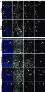 Rabbit IgG (H+L) Cross-Adsorbed Secondary Antibody in Immunohistochemistry (Paraffin) (IHC (P))
