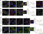 Mouse IgG (H+L) Highly Cross-Adsorbed Secondary Antibody in Immunocytochemistry (ICC/IF)