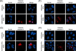 Rabbit IgG (H+L) Cross-Adsorbed Secondary Antibody in Immunocytochemistry (ICC/IF)