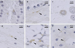 Rabbit IgG (H+L) Cross-Adsorbed Secondary Antibody in Immunohistochemistry (Paraffin) (IHC (P))