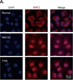 Rabbit IgG (H+L) Highly Cross-Adsorbed Secondary Antibody in Immunocytochemistry (ICC/IF)