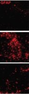 Mouse IgG (H+L) Highly Cross-Adsorbed Secondary Antibody in Immunocytochemistry (ICC/IF)