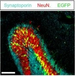 Rabbit IgG (H+L) Highly Cross-Adsorbed Secondary Antibody in Immunohistochemistry - Free Floating (IHC (Free))