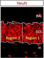 Mouse IgG (H+L) Highly Cross-Adsorbed Secondary Antibody in Immunohistochemistry - Free Floating (IHC (Free))