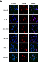 Rabbit IgG (H+L) Cross-Adsorbed Secondary Antibody in Immunocytochemistry (ICC/IF)