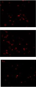 Mouse IgG (H+L) Cross-Adsorbed Secondary Antibody in Immunocytochemistry (ICC/IF)